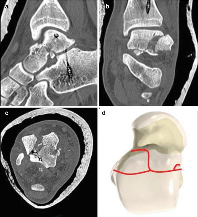 figure 17