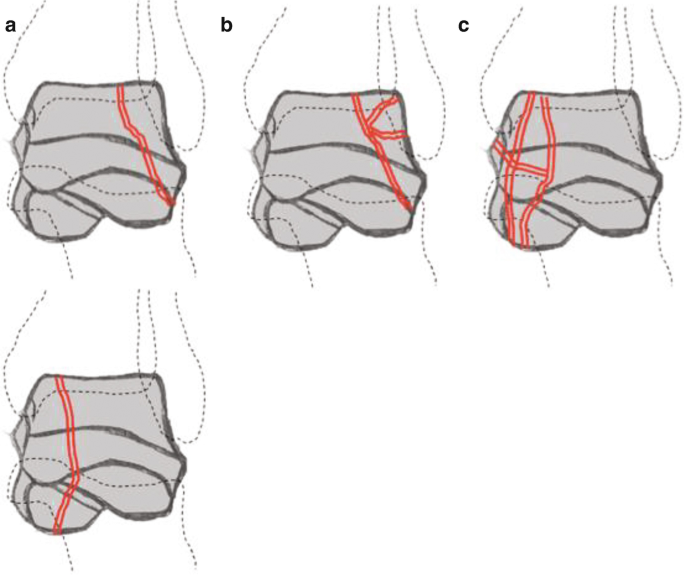 figure 22