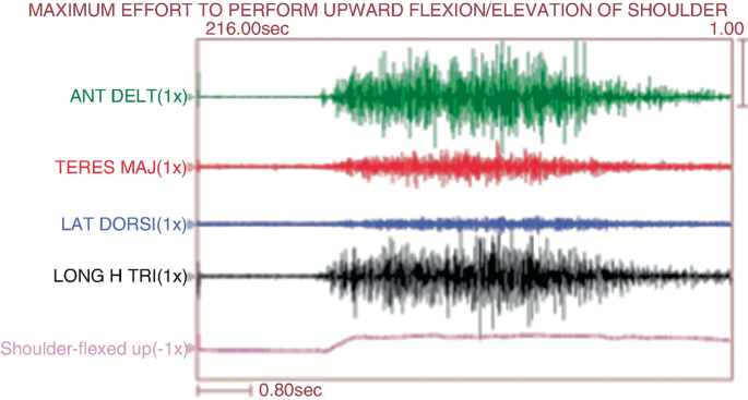 figure 36