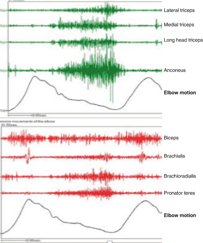 figure 40