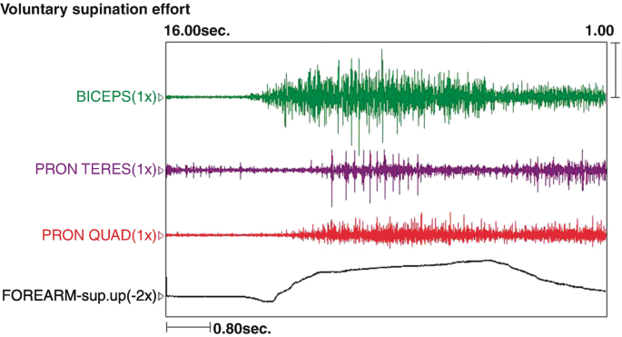 figure 43