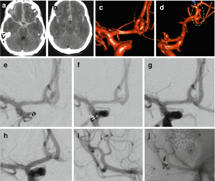 figure c