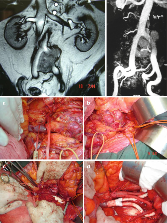 figure 47