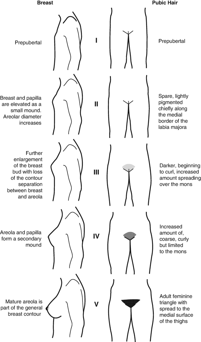 puberty girls pubic hair 