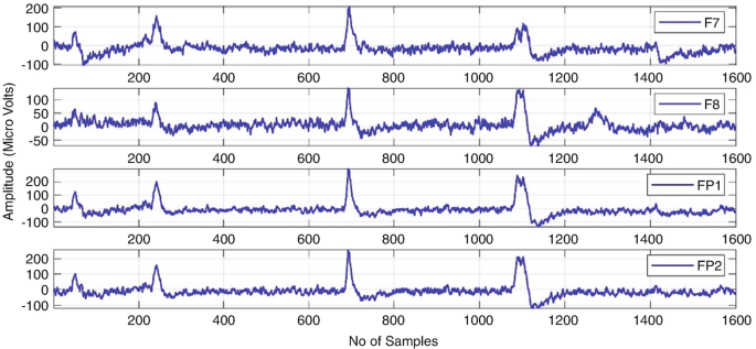 A graph of blink antiques of regular E E G signals. The vertical axis represents amplitude in microvolts. The horizontal axis represents the number of samples. The channels F7, F8, FP1, and FP3, are prevalent with an individual to viewed antiques.