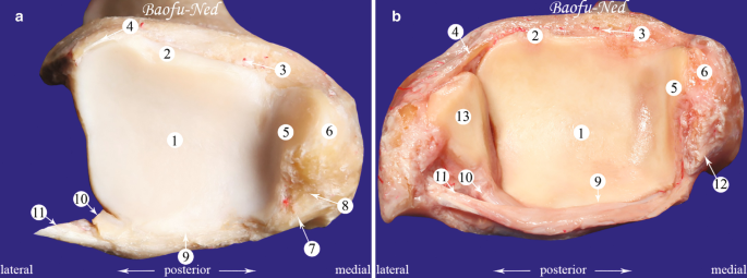 2 photos of the tibia's posterior aspect, with its components identified from 1 to 13. The middle of the bone seems flat, while the border is rough and crooked.