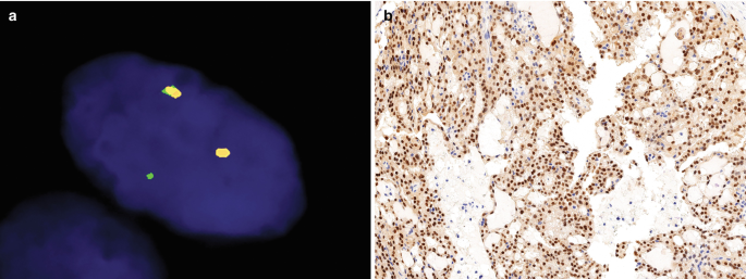 figure 38