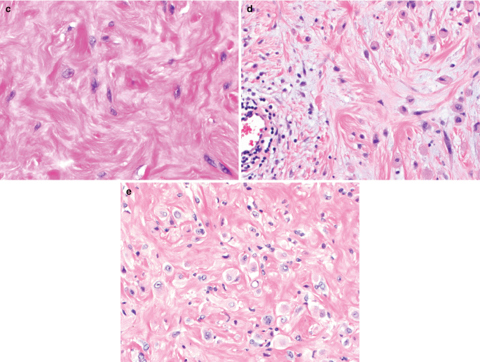 figure 24