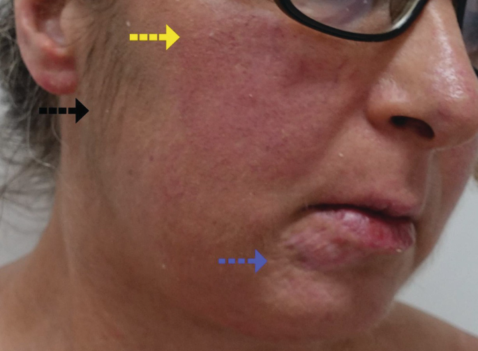 An Intriguing Case of Red Face | SpringerLink