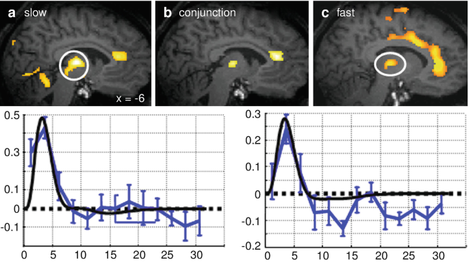 Large-scale functional brain networks in human non-rapid eye movement  sleep: insights from combined electroencephalographic/functional magnetic  resonance imaging studies