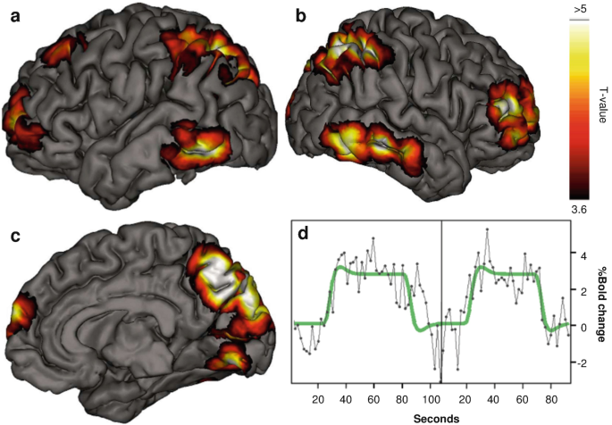 Large-scale functional brain networks in human non-rapid eye movement  sleep: insights from combined electroencephalographic/functional magnetic  resonance imaging studies
