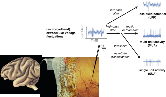 Photos of the brain and its zoomed-in part show the neuropil. The raw extracellular voltage fluctuations graph leads to local field potential, multi-unit activity, and single-unit activity.