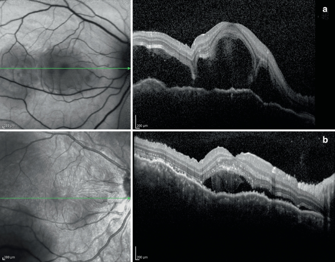 figure 16