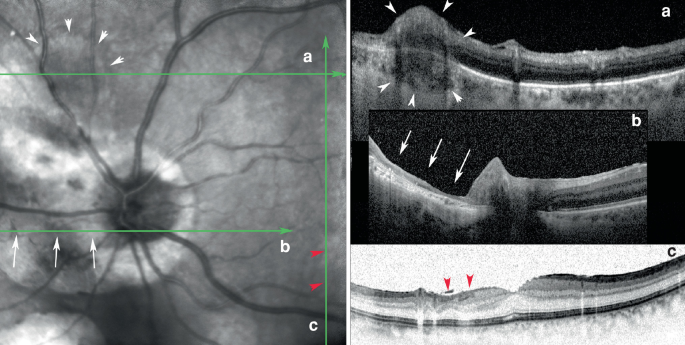 figure 24