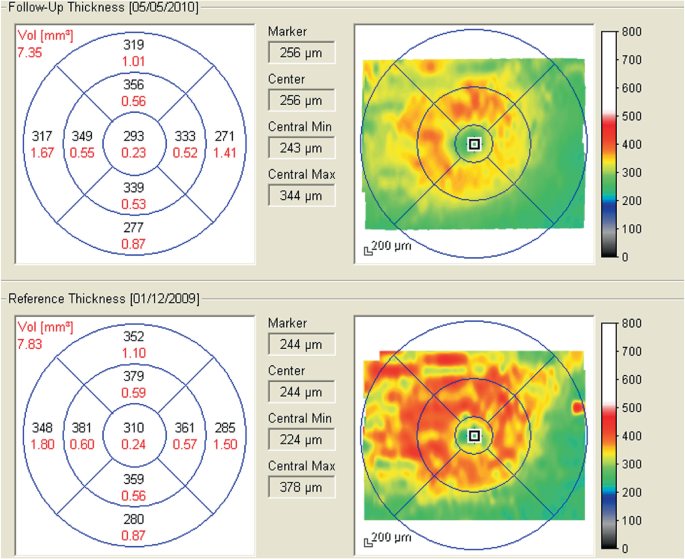 figure 54