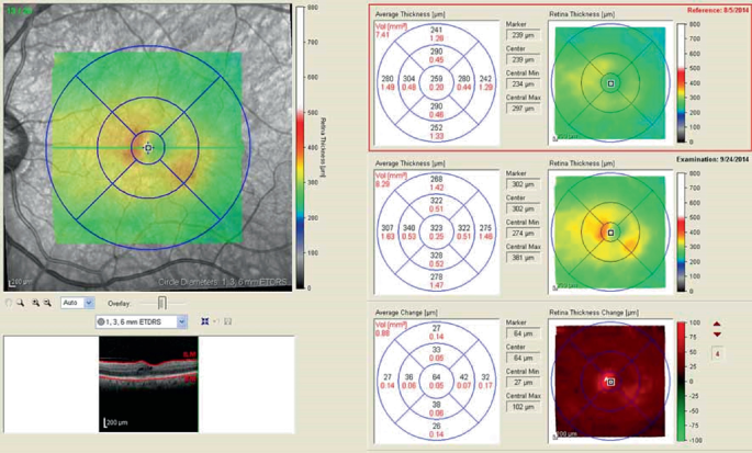 figure 19