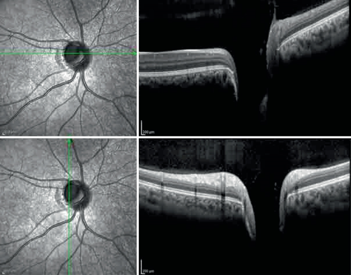 figure 32