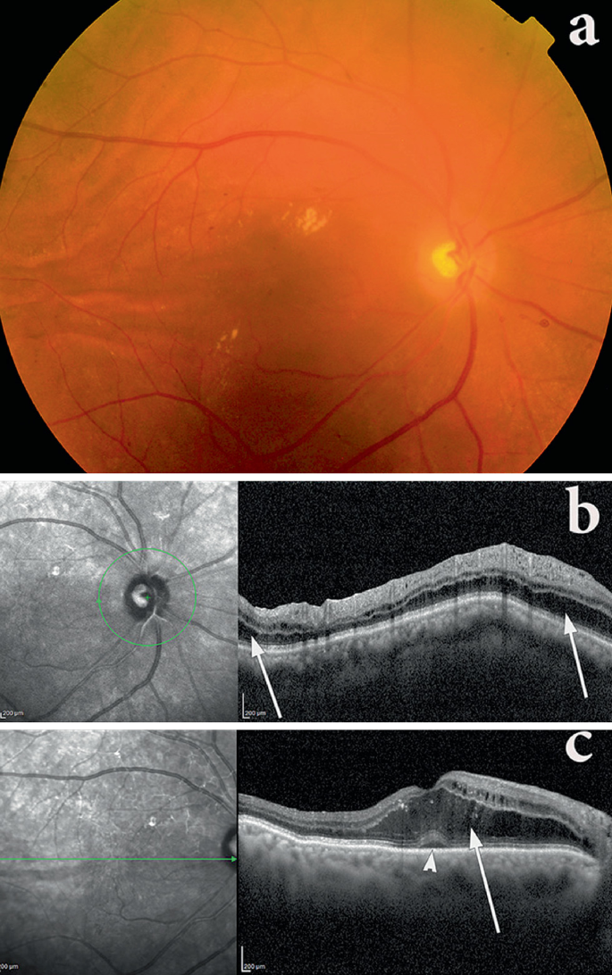 figure 74