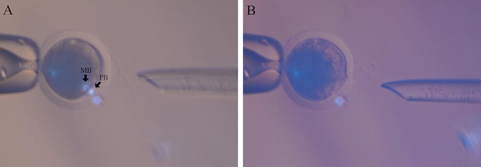 Two images labeled a and b depict mature oocyte enucleation. There is a circular structure in both images with a needle at the right. In the first image, two smaller circular shapes are highlighted with arrows. They are labeled M I I And P B.