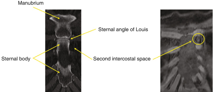 Two images are shown. The first image shows a tubular structure with a wide mouth whereas the second picture shows the middle plane space surrounded by irregular rib-like structures