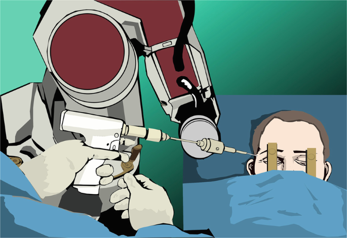 A painting depicts the use of robotic device in epilepsy surgery.