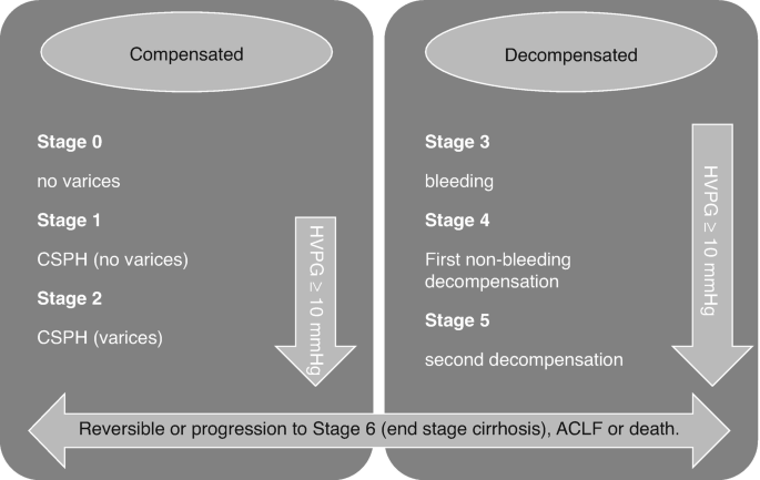 A schematic for end stage cirrhosis, with patients' stages of compensated and decompensated, H V P G values, and progression to stage 6 or death from 0.