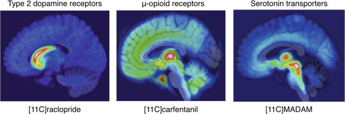 An echo-planar image depicts the type 2 dopamine, mu-opioid receptor, and serotonin transporters from left to right.