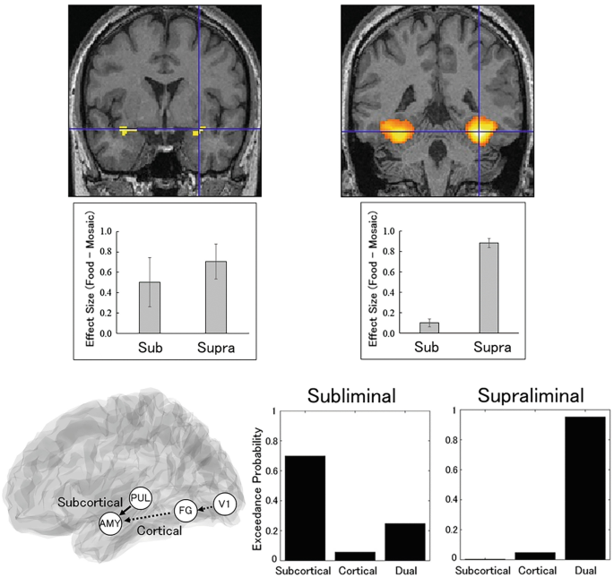 An image explains the brain regions. The amygdala parts of the brain are highlighted and a vertical line moves across it indicating the activation focus. The bar graph explains the subliminal condition.