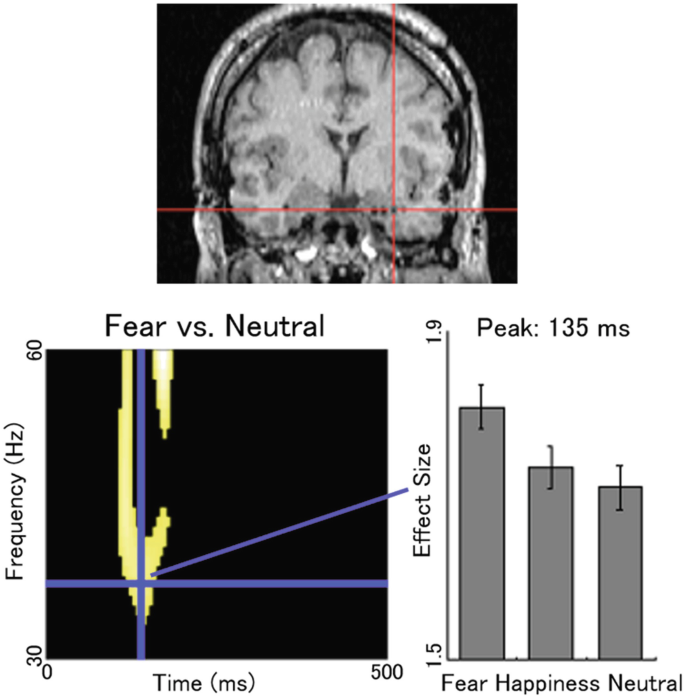 An image explains the brain regions. The amygdala parts of the brain are highlighted and a vertical line moves across it indicating the activation focus. The bar graph explains the effect size with respect to fear, happiness, and neutral.