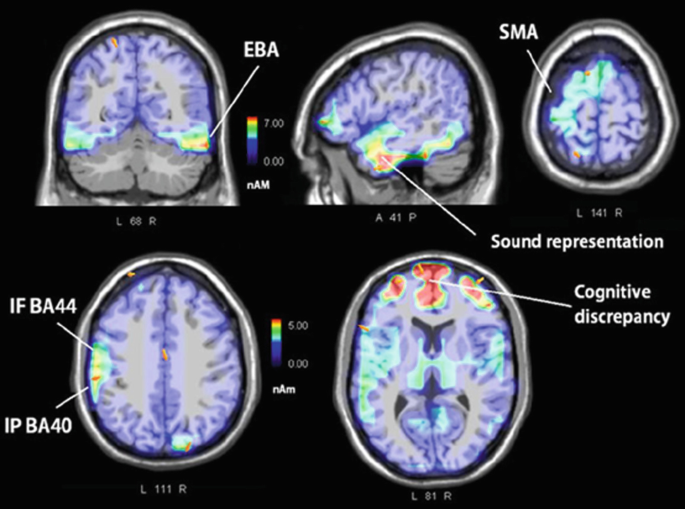 A magnetic resonance imaging of the inferior frontal and parietal areas IF and IP, a mirror system, extrastriate region for body part coding E B A, somatosensory cortex maps of fingers and hand, cerebellum, motor coordination), and supplementary motor area S M A, which encodes acquired motor sequences.