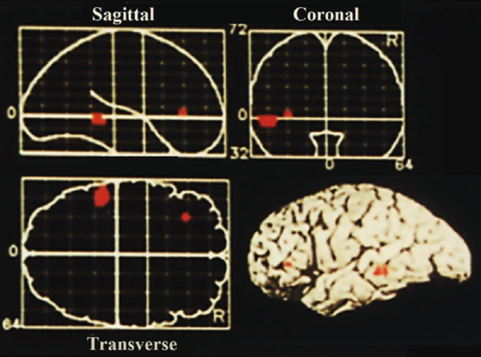 A diagram illustrates the three planar projections of the brain, sagittal, coronal, and transverse.