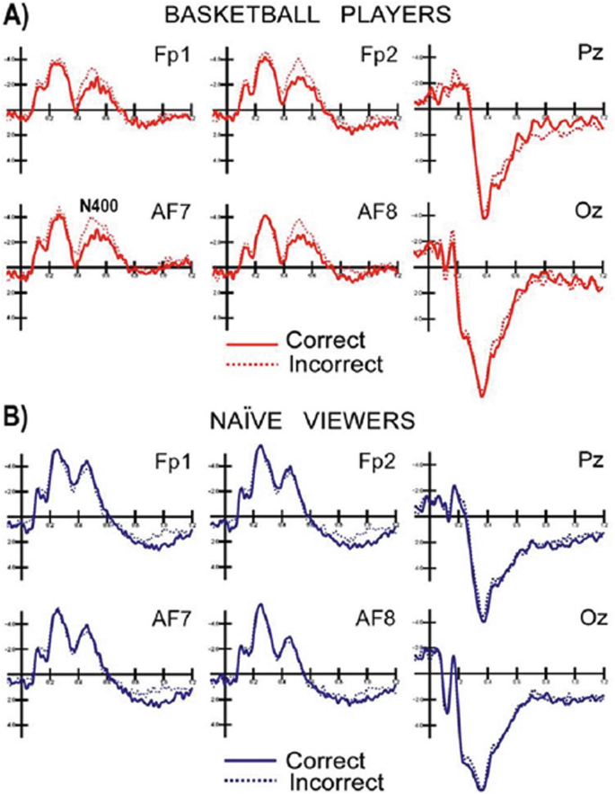 Wave graphs illustrate the anterior N 4 0 0 responses were elicited in response to the improper actions, suggesting the automatic identification of action incorrectness that is only present in professional players.