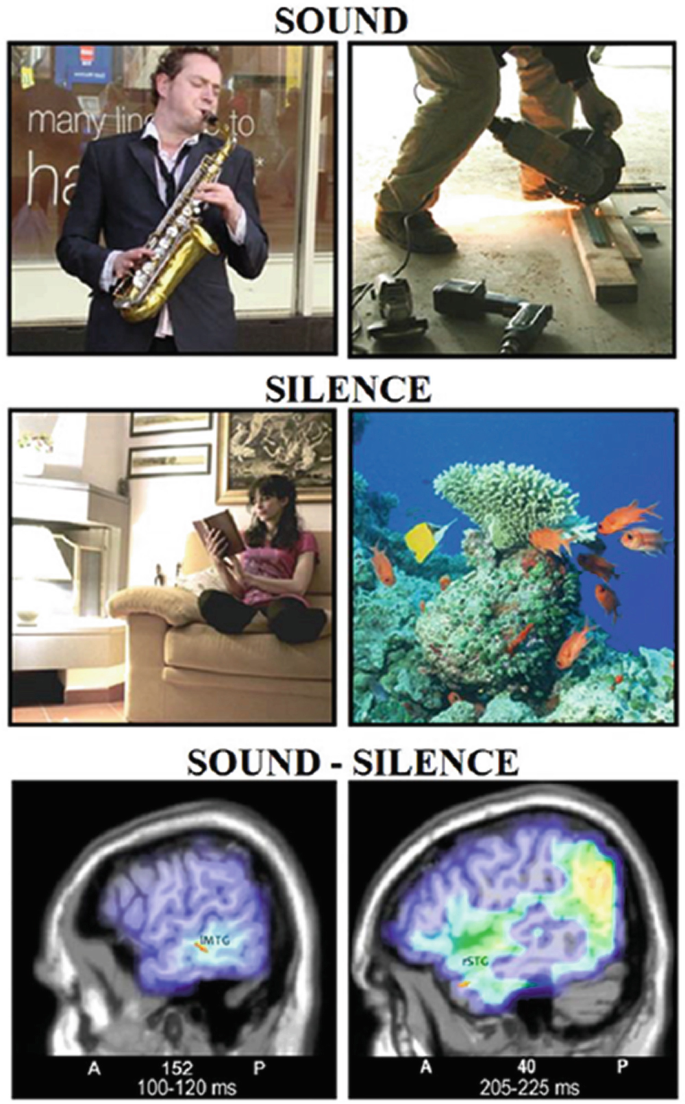 Six images illustrate sound, silence, and sound silence stimuli.