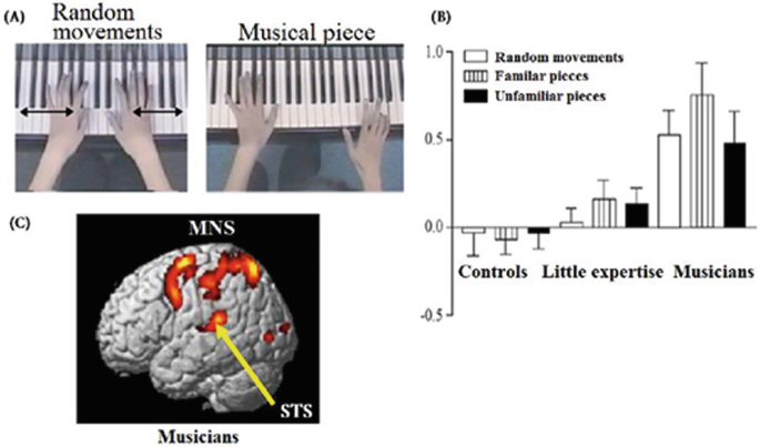 Images of the musicians' random gestures and minds. A graph illustrates the three groups of participants indicated different levels of activation in the left temporal lobe depending on the type of musical performance they gave, where familiar pieces have the highest peak.