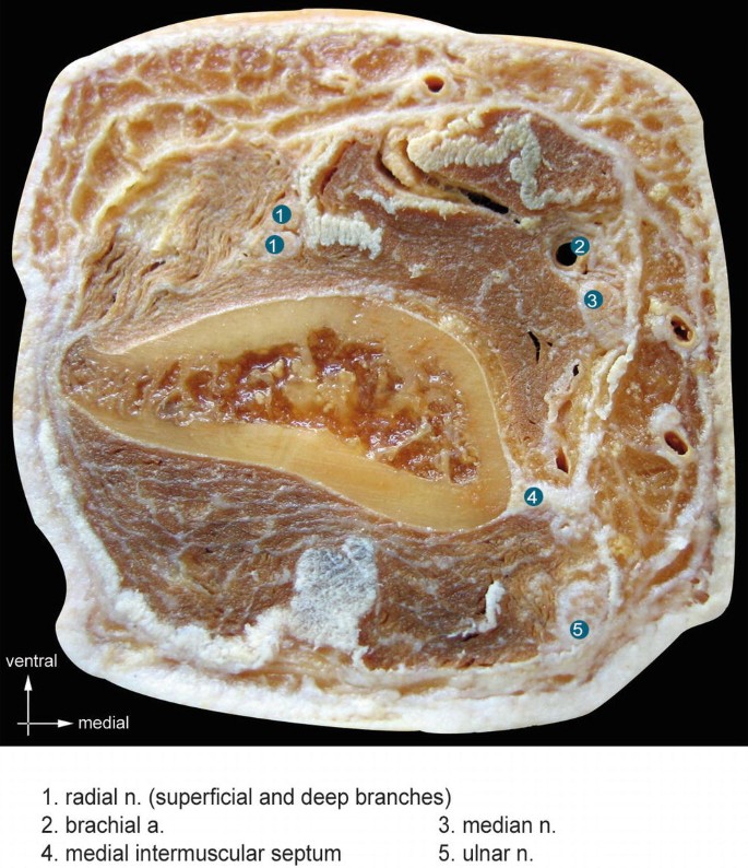 A photograph illustrates a cross-section of the anatomical section at the distal quarter of humerus in ventral versus medial view. The components of the section are marked with numbers 1 to 7.