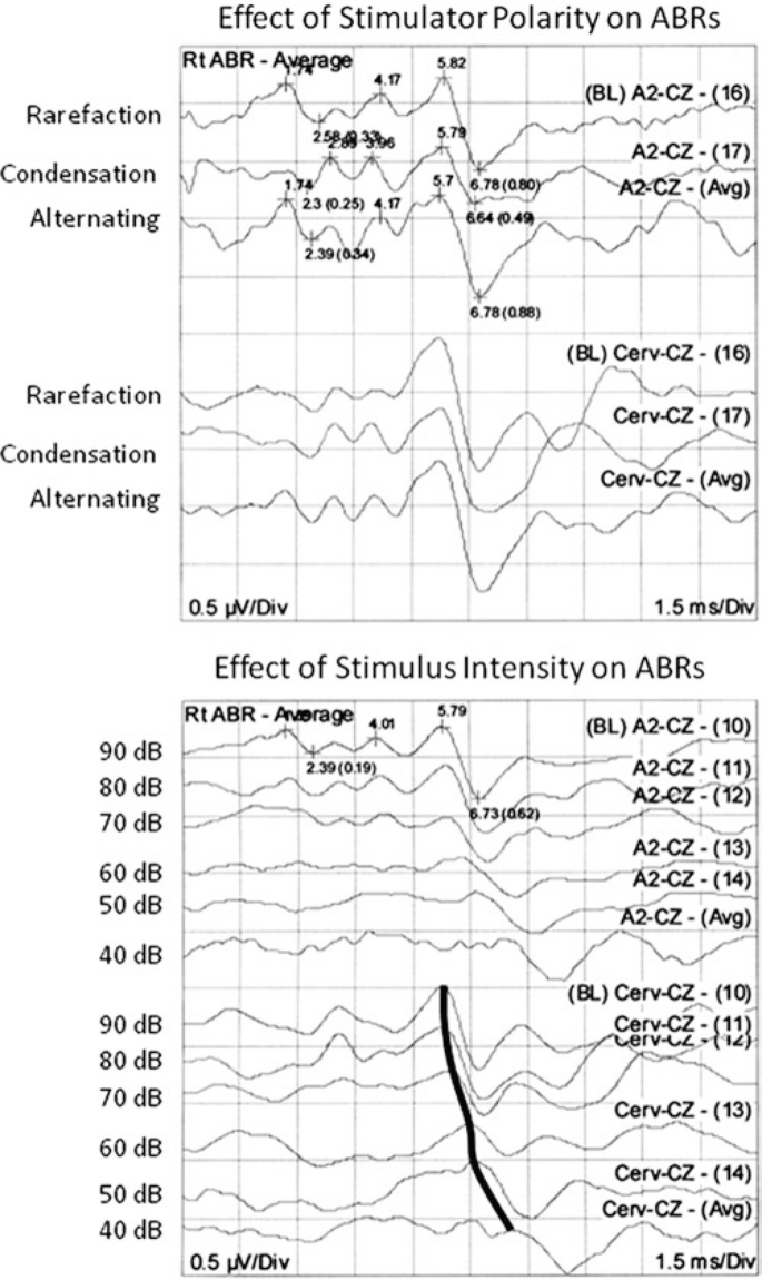 The two waveforms represent the effect of stimulator polarity on A B Rs and the effect of stimulus intensity on A B Rs.