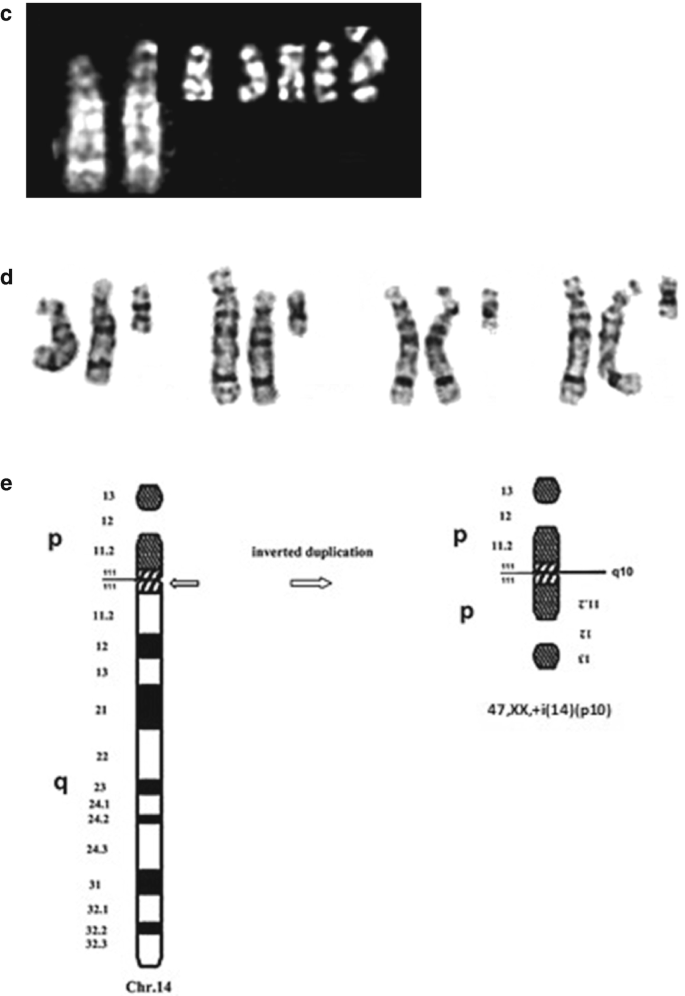 Marker Chromosomes | SpringerLink