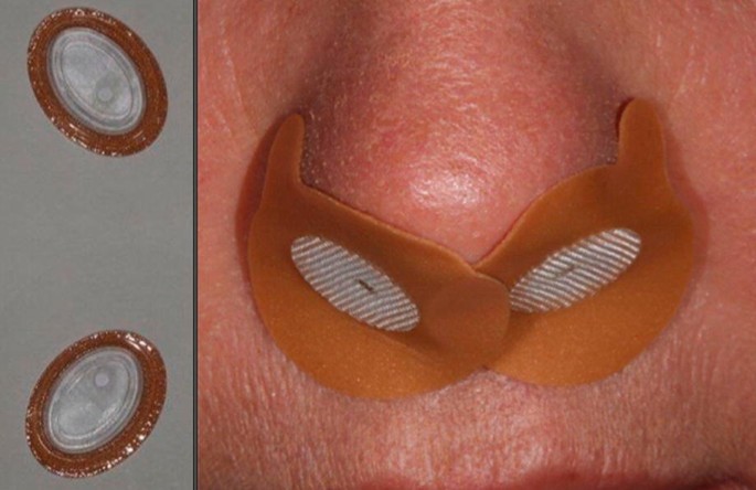 Two photographs. The photo on the left has valves which are still in their packaging. In the photo on the right, the valves are already worn on a person's nose. It is round in shape, with a small extended part on one side.