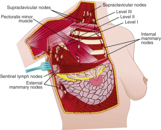 Breast, Lactating - Gross Anatomy Flashcards