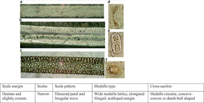 6 microphotographs and a table depict guard hairs of rat. A, main pattern of scales on proximal end. B, scale pattern on distal part. C, whole mount. D, and F, cross sections. At the bottom, a table with 5 columns depicts features of the hair.