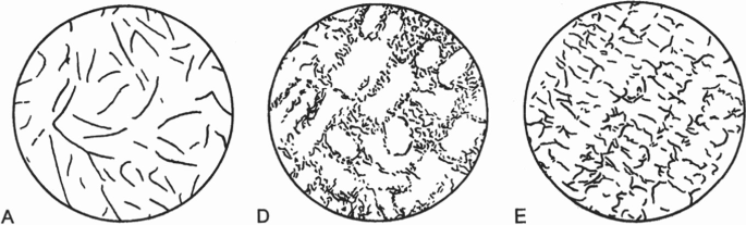 A set of 3 images depict the different arrangements of graphite lamellae. Arrangement A has the lamella far away, arrangement D has the lamella trying to move closer, and arrangement E has the lamella quite close.