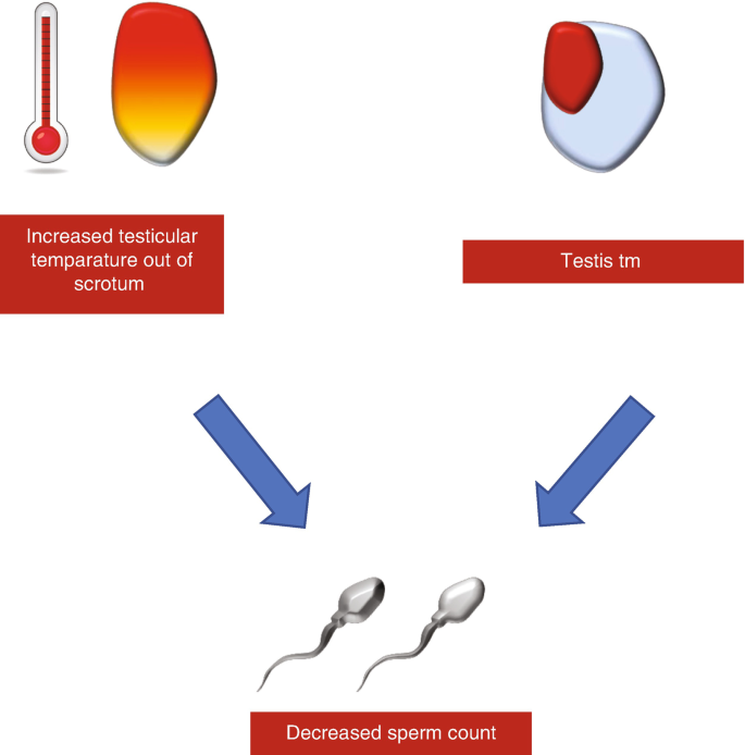 l-carnitine treatment varicocele Therapy in Oligozoospermia (Varicocele, Cryptorchidism, Inflammation, and Seminal Tract Infections) beauty juice
