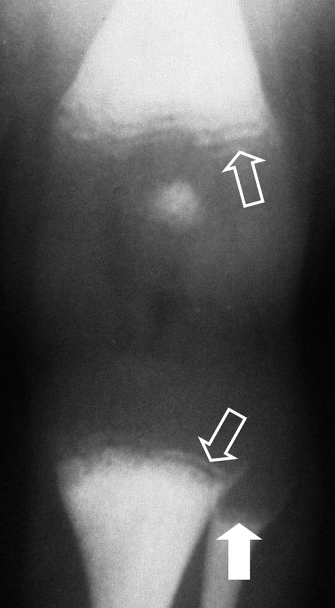 Normal Variants, Congenital, and Acquired Disorders | Springer Nature Link  (formerly SpringerLink), image size:685x1244