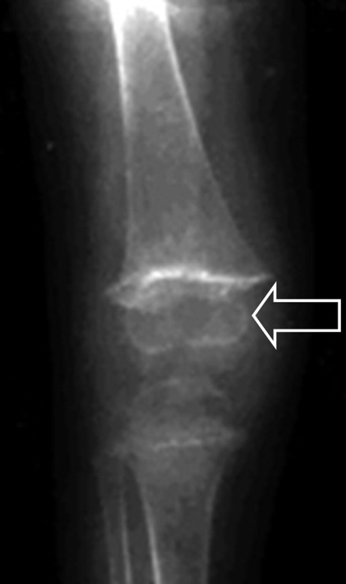 Normal Variants, Congenital, and Acquired Disorders | Springer Nature Link  (formerly SpringerLink), image size:685x1155