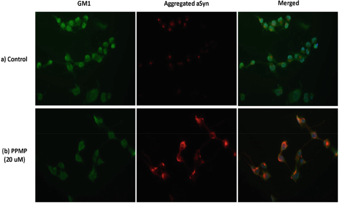 Immune dysfunction in Niemann‐Pick disease type C - Platt - 2016 - Journal  of Neurochemistry - Wiley Online Library