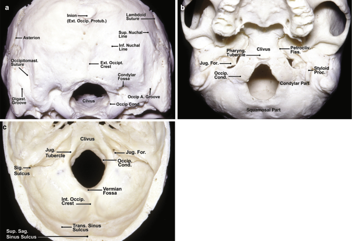 Microsurgical Anatomy of the Cerebellopontine Angle and Its Suboccipital  Retromastoid Approaches | SpringerLink