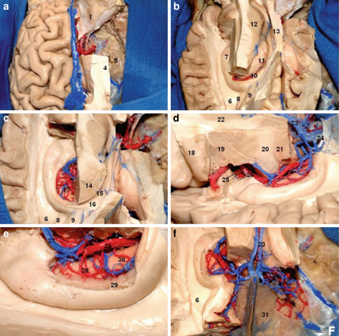 Six photos of temporal anatomical gyri. The internal area is marked with numbers ranging from 1 to 31.