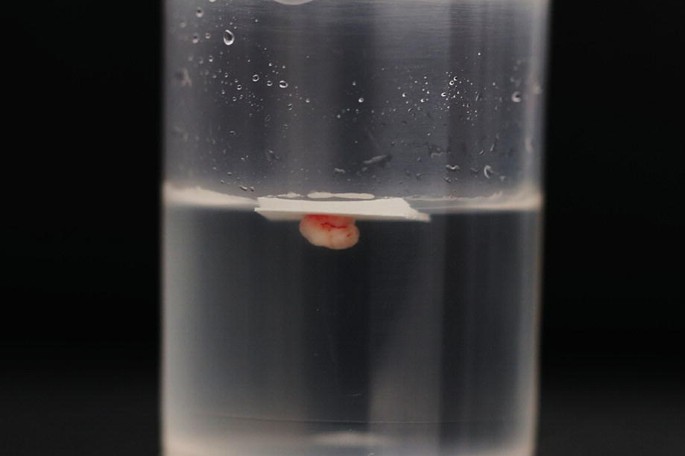 A photograph of a glass container containing the soft tissue biopsy in a solution of formalin.