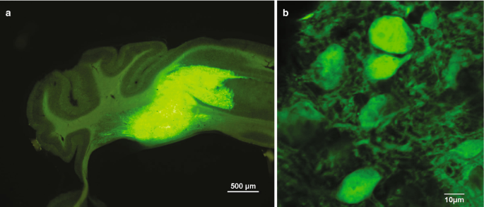 Two-part M R I of the cerebellum of a mouse labeled a and b. Part a is a fluorescent graft. Part b is a cluster of cells in the graft in fluorescent.