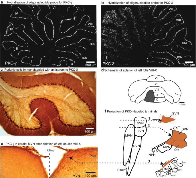 6 figures. A and B, 2 images of hybridized rat cerebellum with an oligonucleotide probe for P K C-gamma and P K C-delta, respectively. C, an image depicts Purkinje cells immunolabeled with antiserum to P K C-delta. D, an illustration depicts a unilateral ablation of left folia from 6 to 10. E, an image depicts P K C-gamma in caudal M V N after ablation of left lobules 8 to 10. F, an illustration of 3 transverse sections depicts the projection of P K C-gamma labeled terminals.